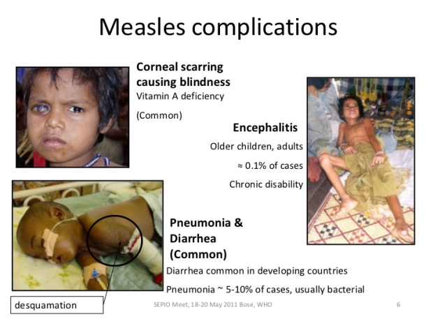 measles-elimination-orig-6-728